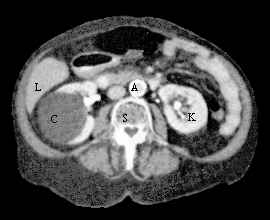 [Figure 25-14]